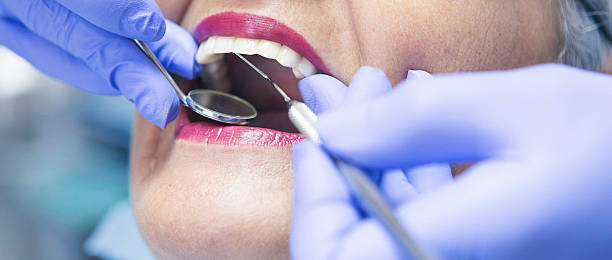 Best Emergency Treatment for Oral Infections in Orinda, CA